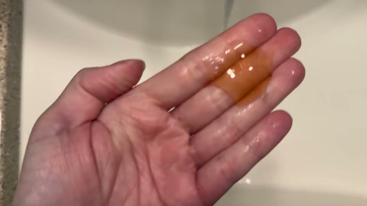 A small amount of amber RoyceDerm coal tar shampoo gel in an open palm, showing the translucent medicated gel texture
